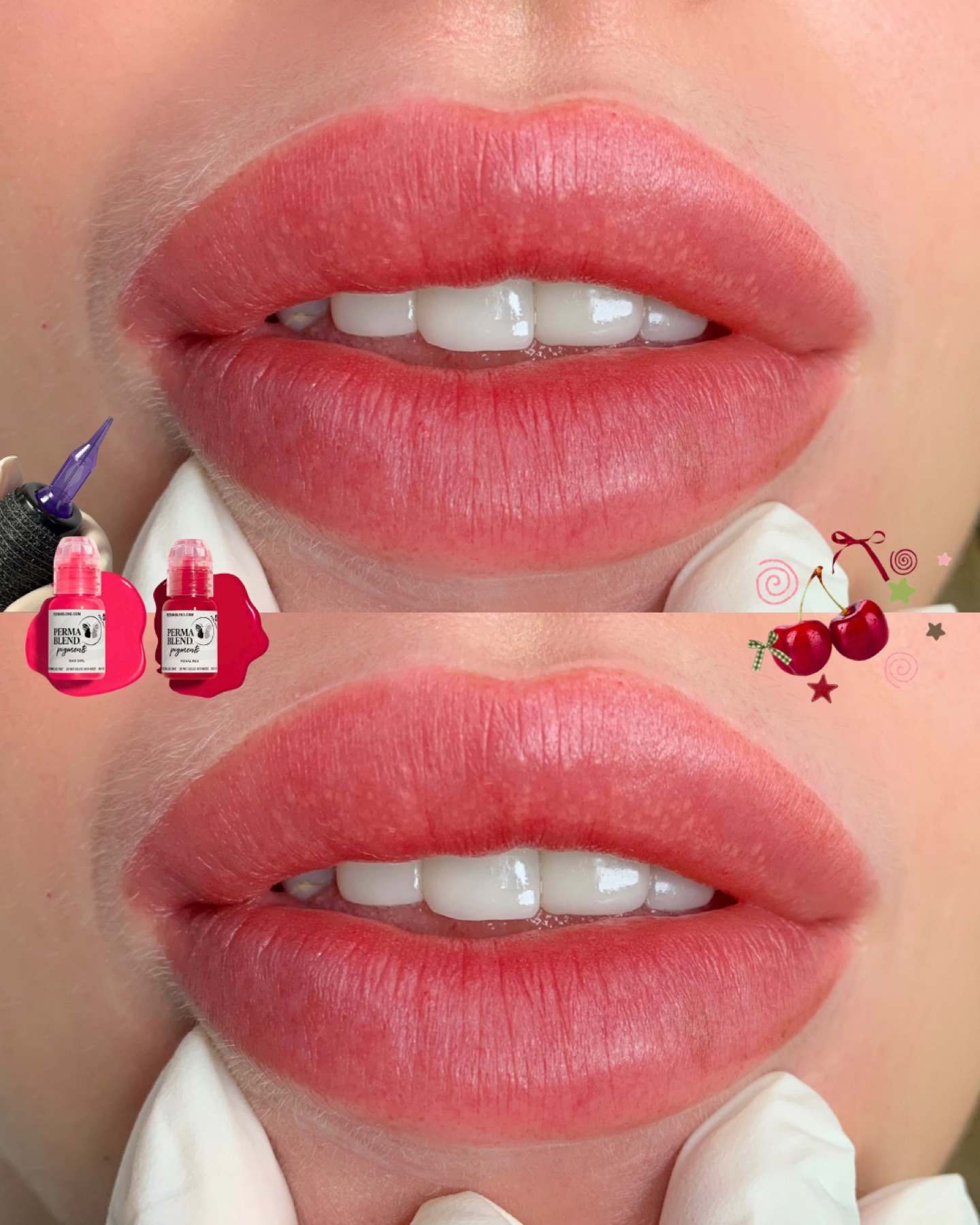Healed lip blush result